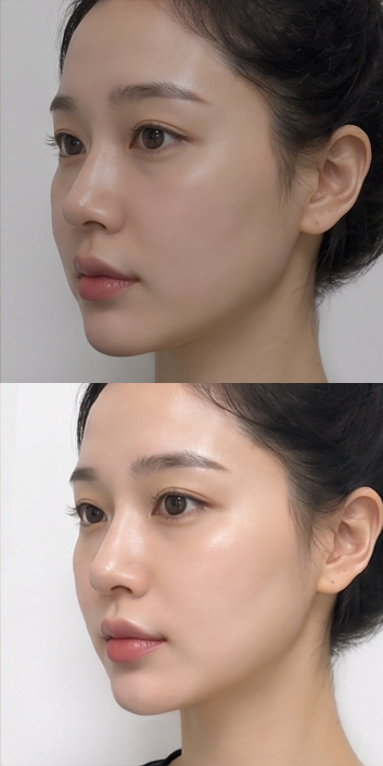 바비라인의원 전후사진